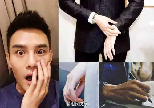 研究称无名指比食指长,更男性化