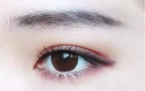 切开双眼皮的价格贵吗