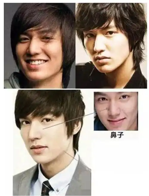 李敏镐最新生图不敢认!脸颊胖到像气球,疑似整容后遗症爆发_腾讯新闻