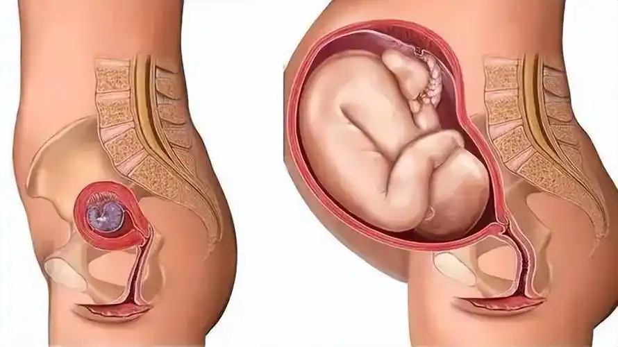 而经过了十月怀胎,足月的宝宝会把子宫撑大到原来体积的20倍,外表上