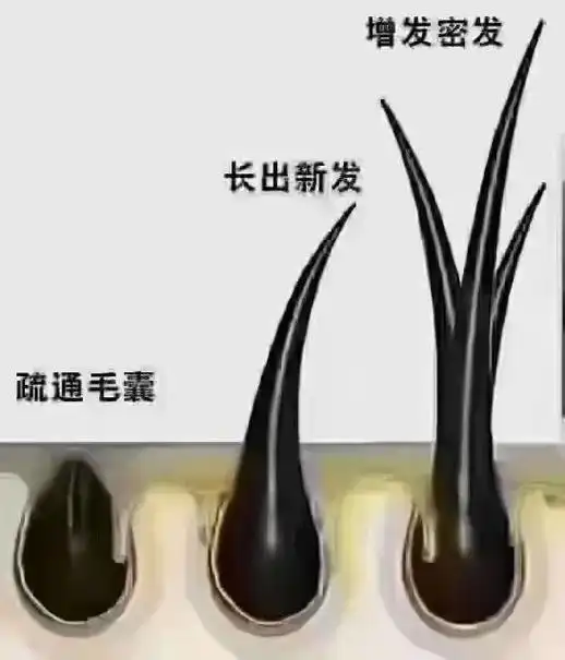 防脱生发四部曲92.防脱生#养发护发 #头皮护理 #品牌传播 - 抖音