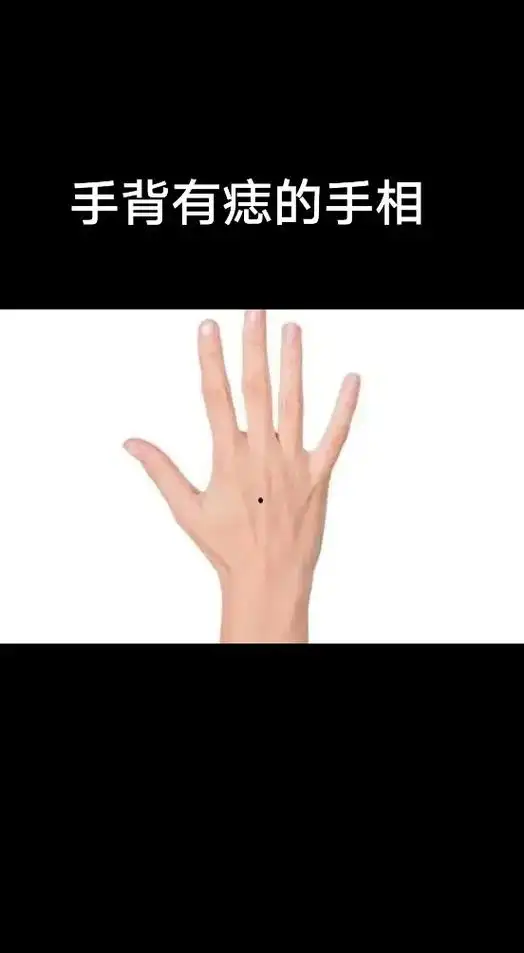 手背长痣的手相分析