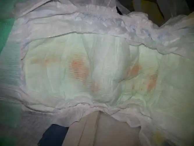 又不像血迹,因为干了后没有变成褐色. 宝宝目前全亲喂,身体