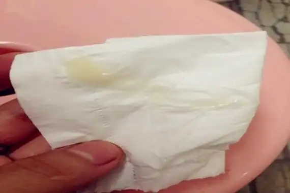 受孕成功后白带图片是怎样的?有这些变化代表你受孕成功了!有图慎入!