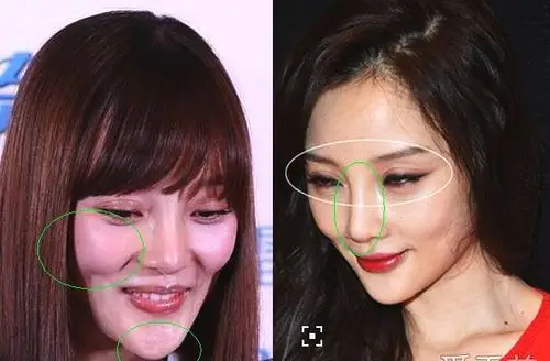 李小璐双眼皮竟可以夹死一只苍蝇?网友直呼:割了三次就是牛!