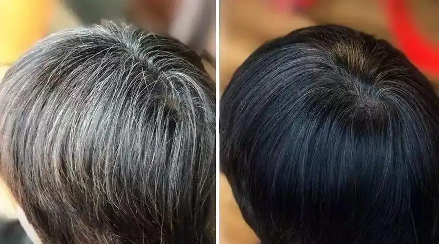 怎么能将白发变黑发?