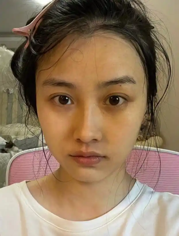 皮肤暗沉,有黄气怎么办?注意抗氧化问题改善皮肤状态