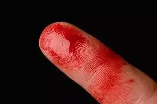 手被刀割了流血图片 - 搜狗图片搜索