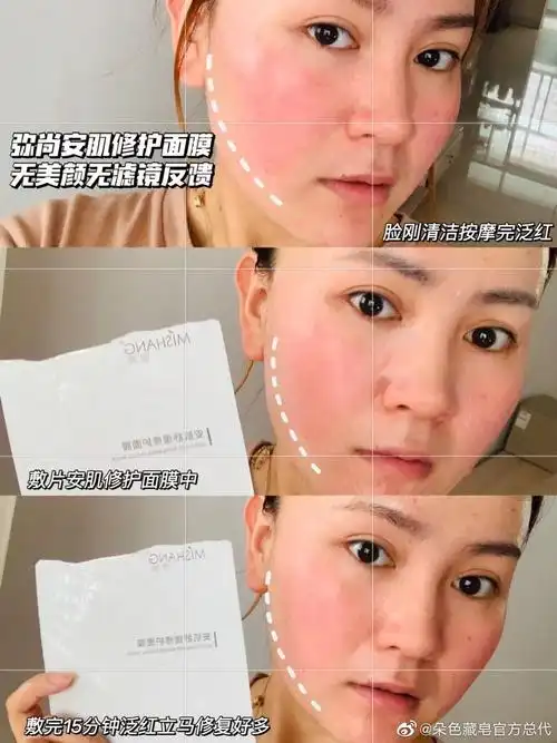 弥尚护肤品成分对皮肤刺激吗弥尚护肤品适合痘痘肌吗找谁买弥尚护