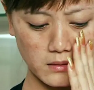 30岁后皮肤不好爱长斑的姐妹是该找找自身的原因了