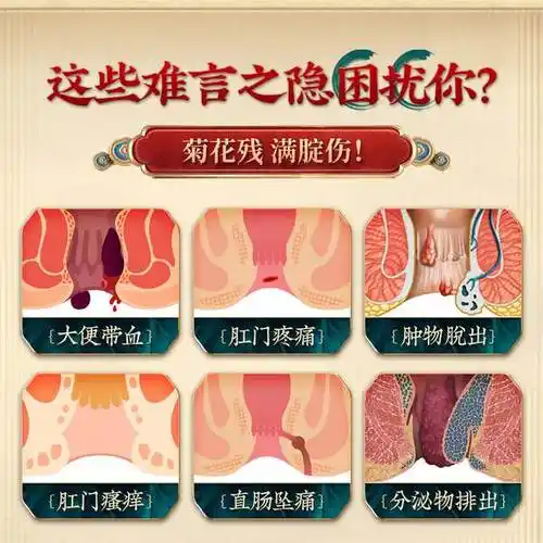 百草妙方卫志膏芃凡医屁舒草本膏致可克舒凝胶冷敷凝胶肛用痒