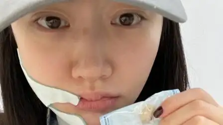 景甜脸肿成猪头难认出,鼻子伤疤还未好!