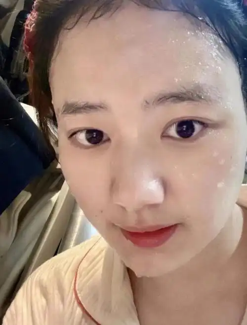 这张白嫩的脸怎么不算好皮肤呢