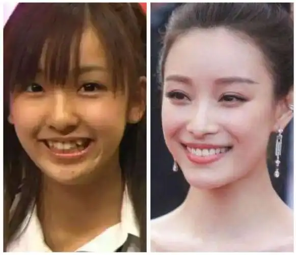 整牙|牙齿|大美人|牙套_网易订阅