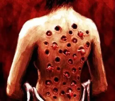 能把人恶心到吐的图片,世界十大最恶心的图片(胆小勿入)