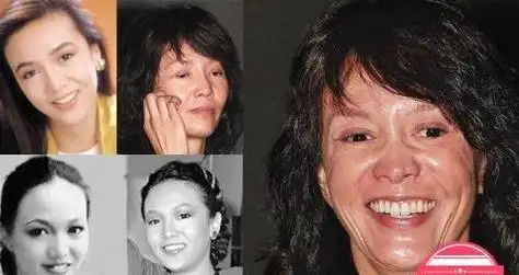 比如说这五位整容失败的女明星,就让我们非常的震惊!