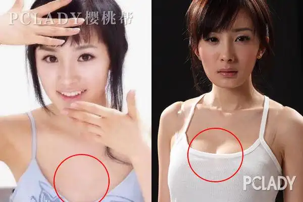 从整容到被离婚杨幂走向人生巅峰