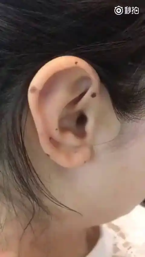 耳朵上的痣相说过很多遍,但依旧有粉丝问我耳垂有痣好不好