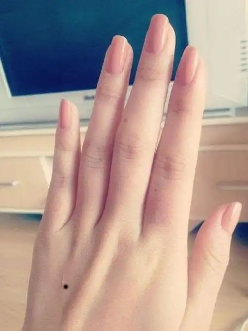 手掌有痣其他位置的命运:1.