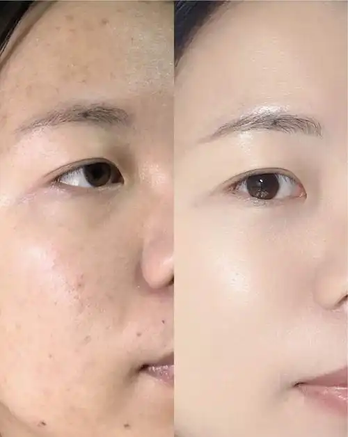 首先大家可能会好奇为什么秋季皮肤会有容易过敏,皮肤状态不稳定