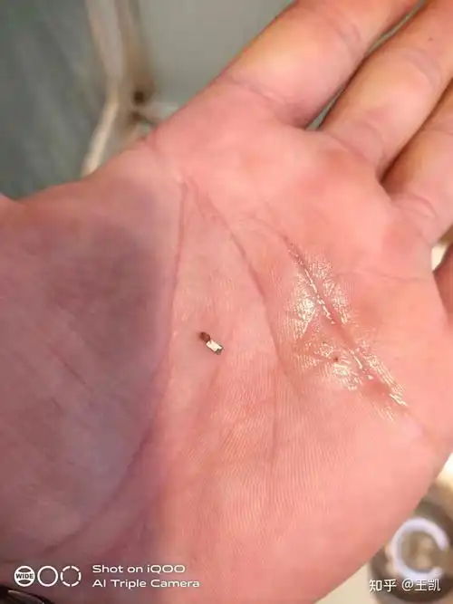 今天下午取出一个钉子,以为还剩一个,于是努力想把它取出,结果发现