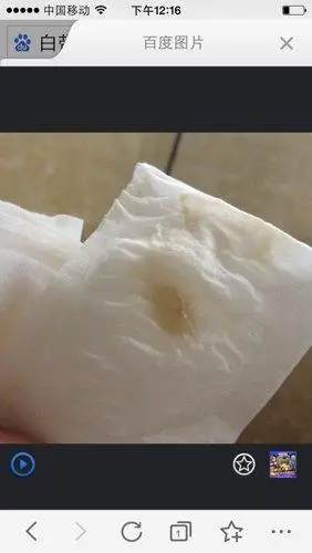 怀孕一个月白带这样怎么回事