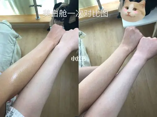 杭州美白舱05 美白舱使用两个疗程纯分享篇8915 现在市面美白的