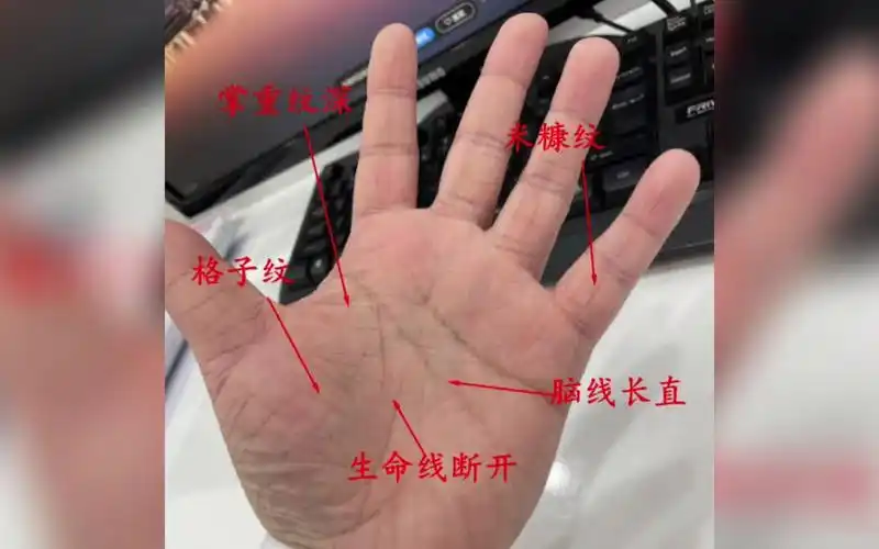 【庞易白-视频讲解】生命线断开?