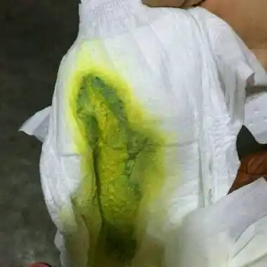 宝宝三个月了,从昨天开始宝宝有点拉稀!一直哭闹,怎麼回事?