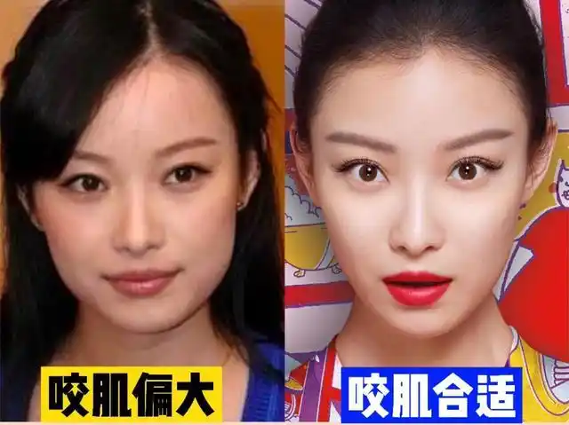 明星都逃不过的"发腮",我们应该如何预防?