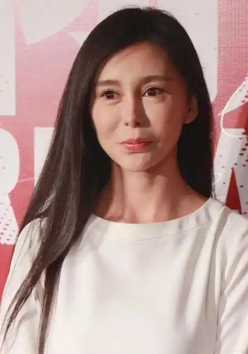 中年女星整容后遗症一堆!脸像鞋拔子,不敢做大表情,演戏没法看