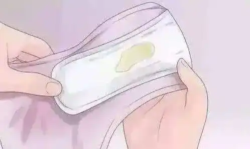 一文稿定!_分泌物_阴道_颜色