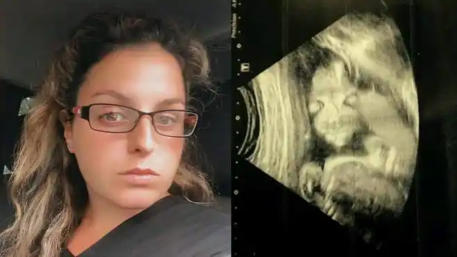 女子怀孕20周开心照b超,看到胎儿影像不淡定了:长相似"恶魔"-母婴亲子