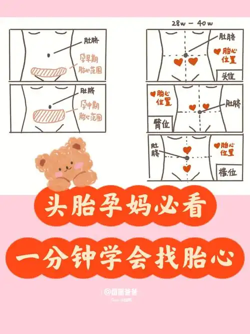 74拒绝焦虑| 孕期各种胎位找胎心秘诀91