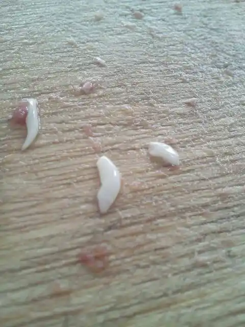 急!洗牛肉的时候抓出了这像蛆一样的虫子!求告知这是什么虫子?