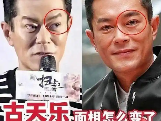 古天乐面相变了