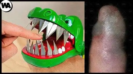 世界上最危险的8种玩具,无形中对人体造成危害,你玩过几个?