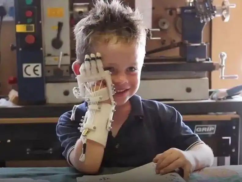 超级英雄出新番3d打印义肢全球免费5年火遍100个国家6000多孩子受益