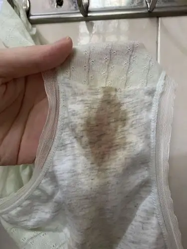 月经回潮?排卵期出血?