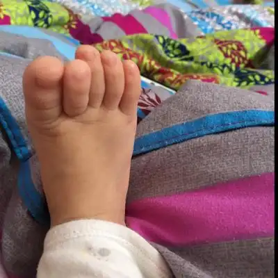 宝宝两只脚的第二个脚趾头翘起来怎麼回事?