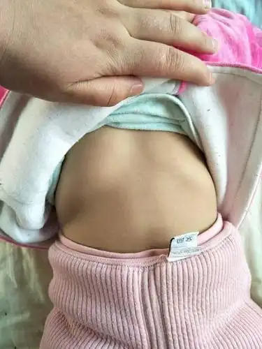 宝宝鸡胸早期症状图 (48)_有来医生