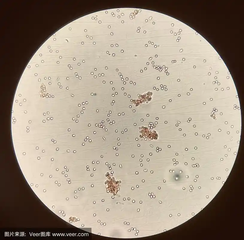 交叉配血试验中的红细胞凝集.用手机拍照.