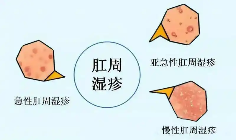 发病与内外多种因素有关手部湿疹的常见症状包括皮肤损伤和皮肤瘙痒