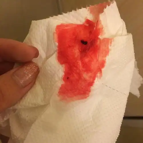 排卵期中.连续两三天这样,有鲜红的血.没来月经.怎么回事?好害怕.