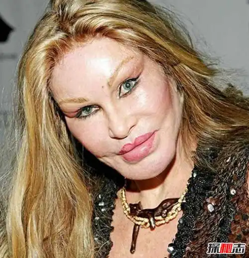 整容失败?整容变毁容的15个真实案例(附对比图片)