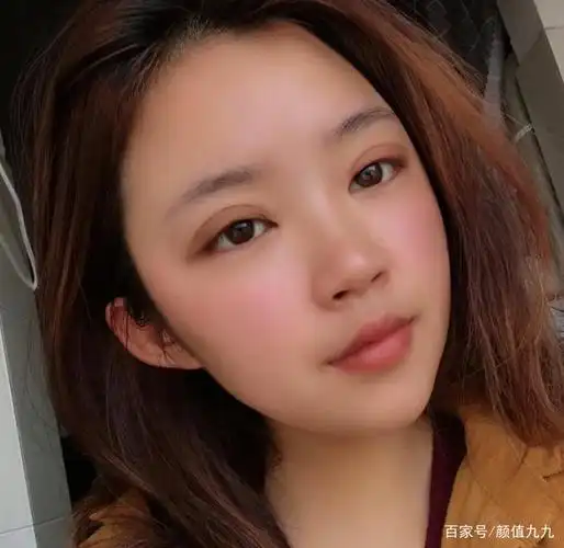 在重庆割的双眼皮还算成功么!