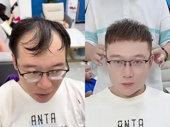 全网最高m发际线看我拿捏