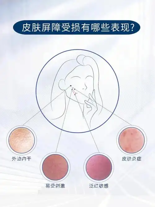 尤美皮肤屏障科普