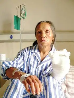 六旬阿婆以身挡刀护邻家孩子 歹徒挥刀自残(图)