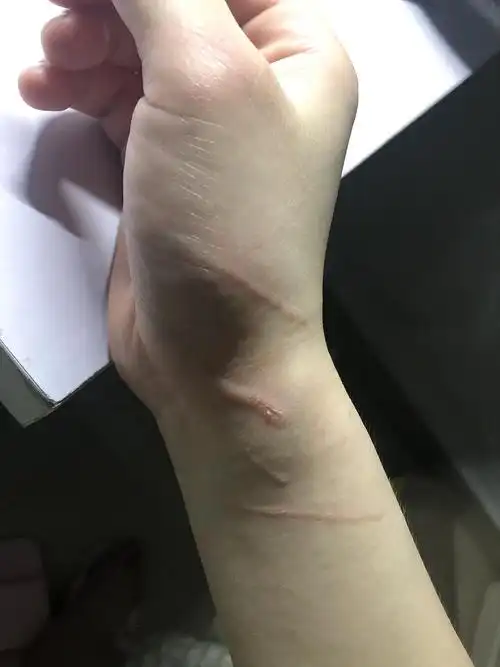 【讨论】从小养到大的猫今天抱它直接下狠嘴咬我?